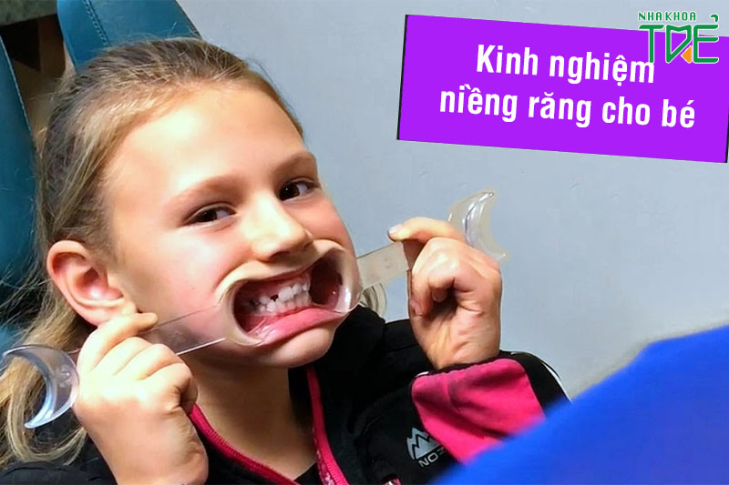 Kinh nghiệm niềng răng cho trẻ: Những điều bố mẹ cần biết