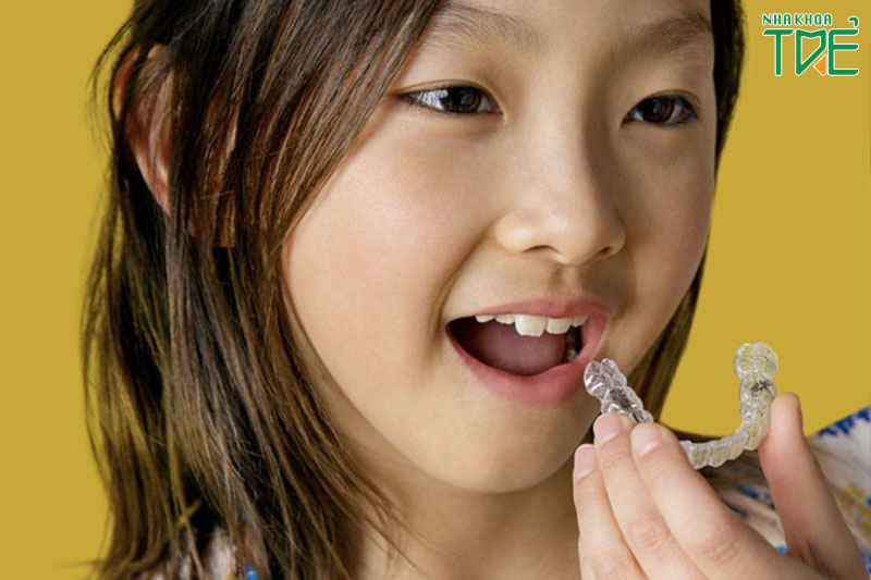 Chỉnh nha cho trẻ em từ sớm để cải thiện răng và khớp cắn