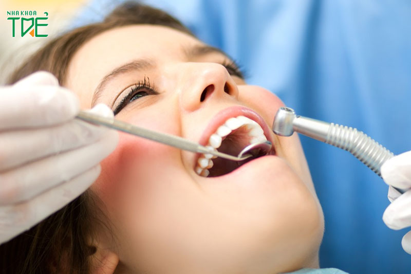 Công nghệ siêu âm lấy cao răng không đau, không chảy máu