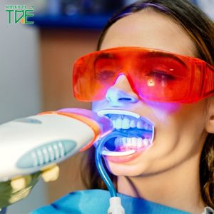 Tác hại của tẩy trắng răng là gì? Có nên tẩy trắng răng hay không?