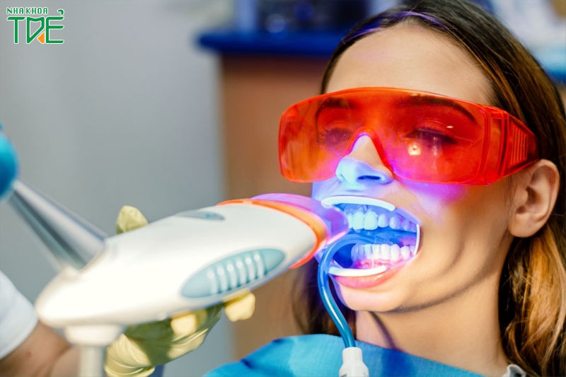 Tẩy trắng răng cần có chỉ định của nha sĩ