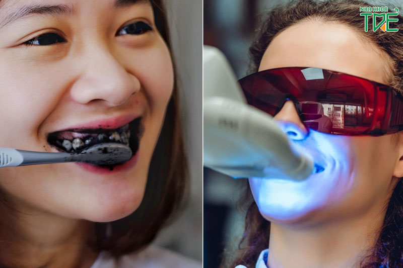Tẩy trắng răng tại nha khoa hiệu quả nhanh chóng hơn các biện pháp tại nhà