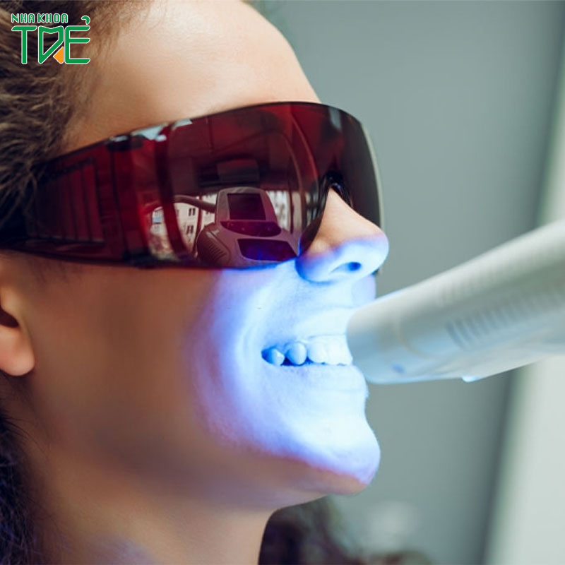 Có nên làm trắng răng bằng laser không? Tác hại & lợi ích
