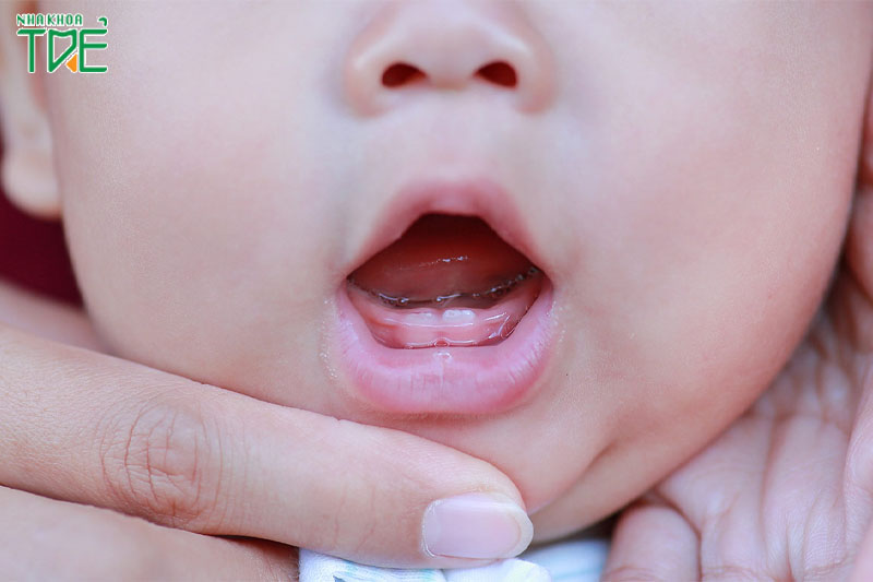 Bé mọc răng sữa thường vào khoảng 6 tháng tuổi