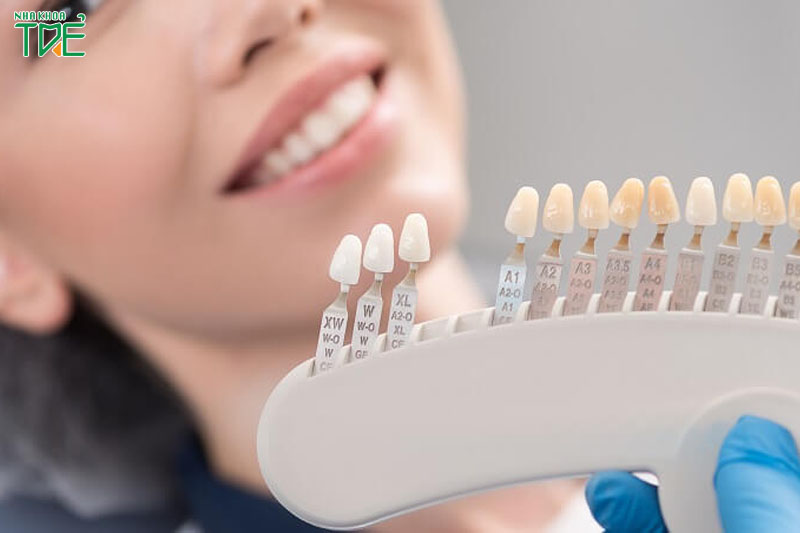 Răng sứ có dải màu đa dạng nên sẽ dễ dàng lựa chọn được màu răng phù hợp nhất