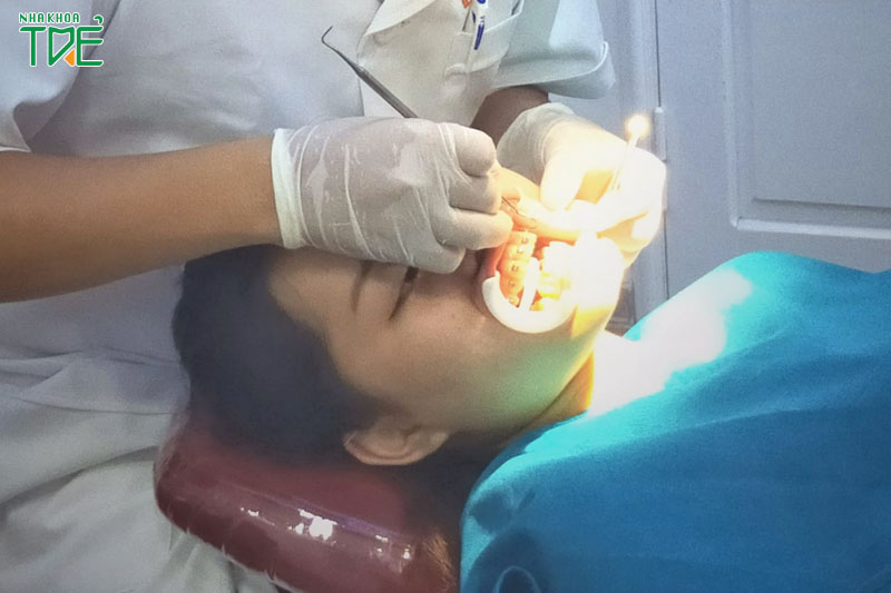 Bác sĩ tay nghề cao sẽ niềng răng đúng kỹ thuật, đạt hiệu quả tối ưu