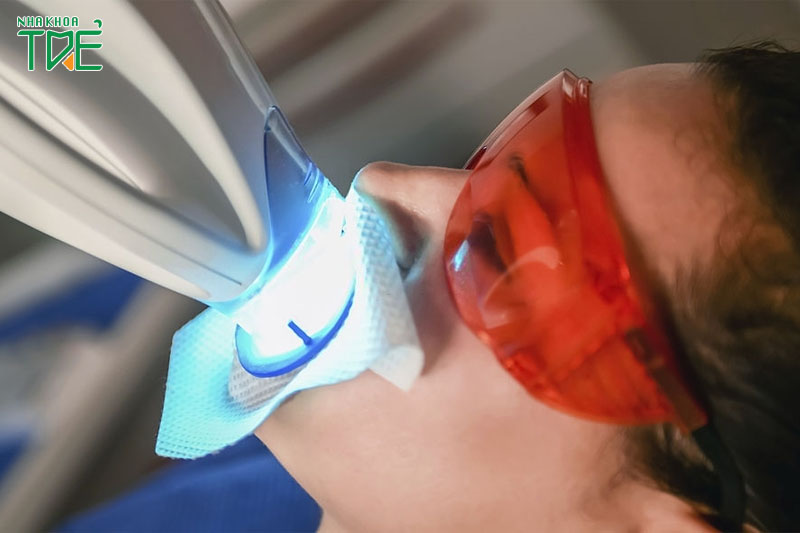 Tẩy trắng răng Laser giá bao nhiêu tiền?