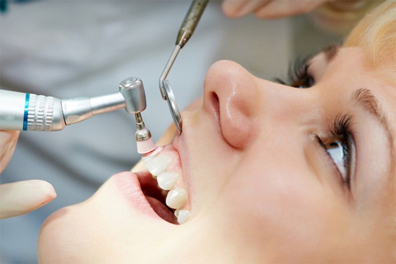 Lấy cao răng tại nha khoa là giải pháp tối ưu nhất