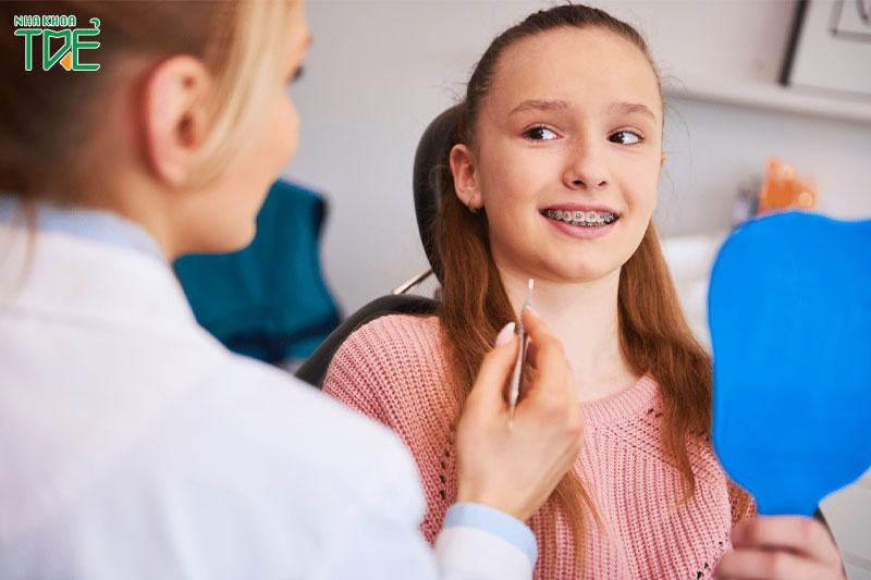 Niềng răng cho trẻ 14 tuổi: Phương pháp điều trị và chi phí cụ thể