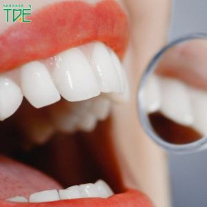 [Bỏ túi] Cách bảo quản răng sứ tăng độ bền đẹp, tuổi thọ lâu dài