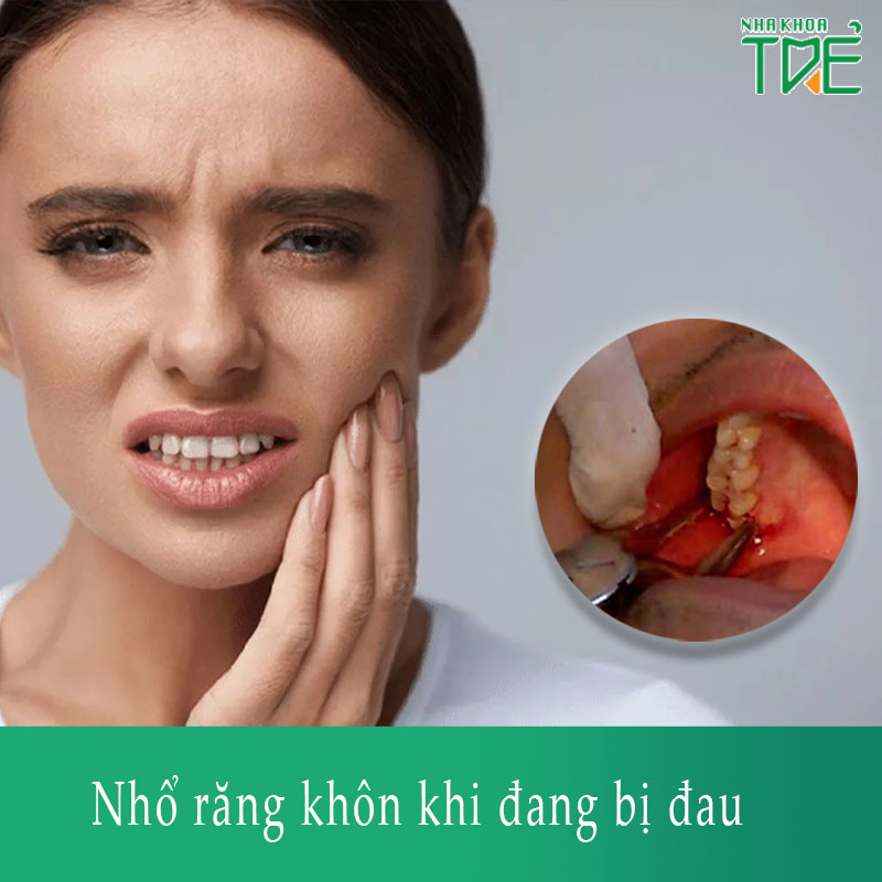Nhổ răng khôn khi đang bị đau có nên không? Cần lưu ý những gì?