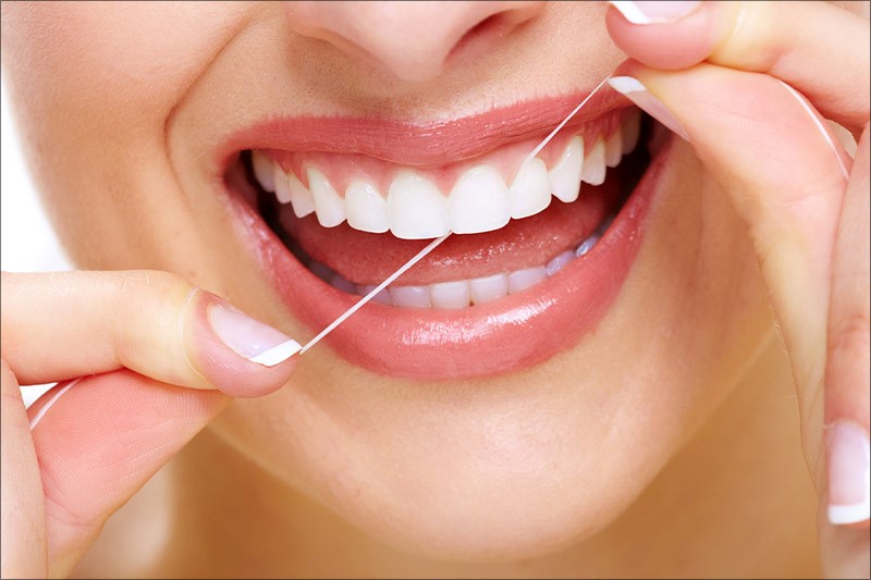 Chỉ nha khoa giúp làm sạch mảng bám trong kẽ răng và mắc cài mà không gây đau đớn