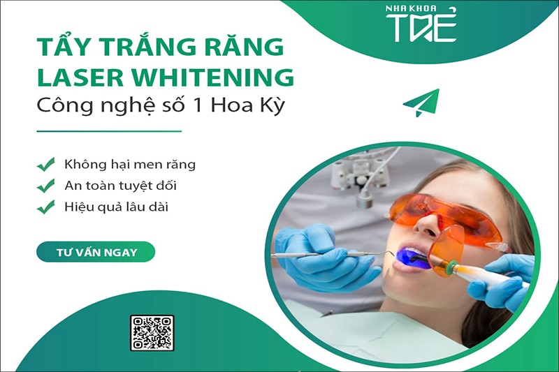Công nghệ tẩy trắng răng Laser Whitening