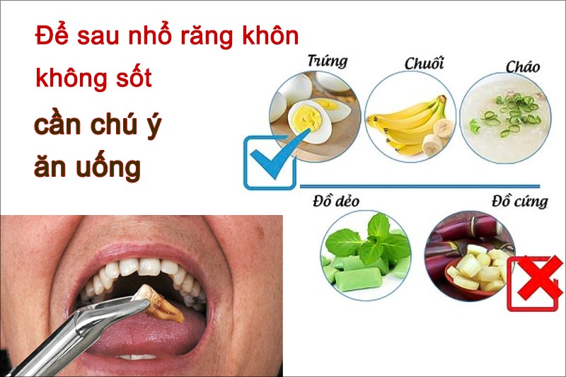 Ngoài vệ sinh khoang miệng đúng cách, cần chú ý ăn uống để sau nhổ răng không sốt