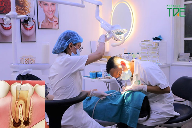 Thời gian lấy tủy phụ thuộc vào tình trạng răng miệng và tay nghề bác sĩ