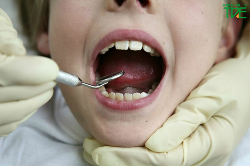 Thăm khám nha khoa để có phương pháp điều trị sâu răng thích hợp