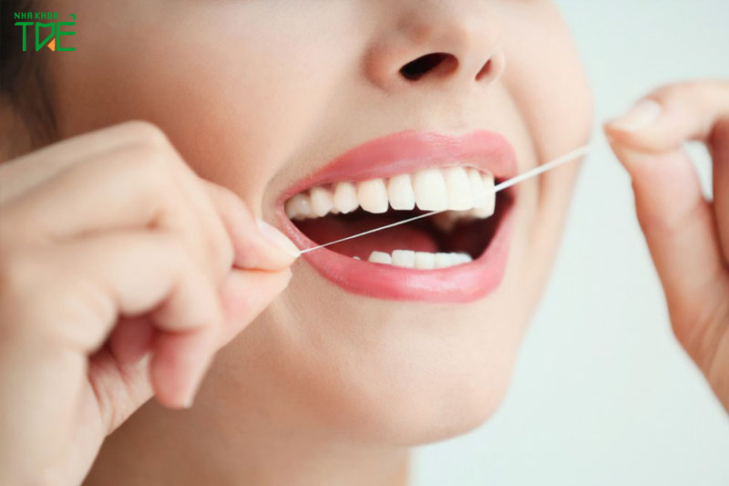 Vệ sinh răng miệng kỹ lưỡng phòng ngừa sâu răng
