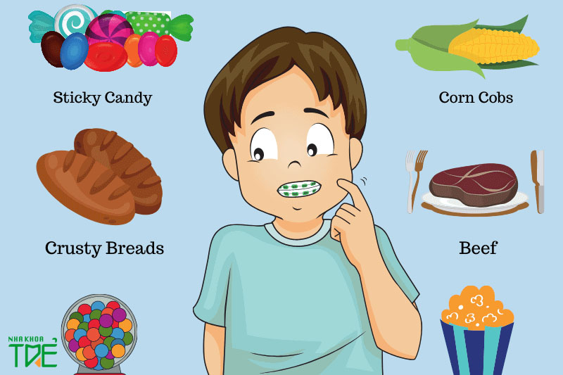 Chế độ ăn uống trước và sau khi tháo niềng răng