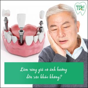 Thực hư việc làm răng giả ảnh hưởng đến sức khỏe