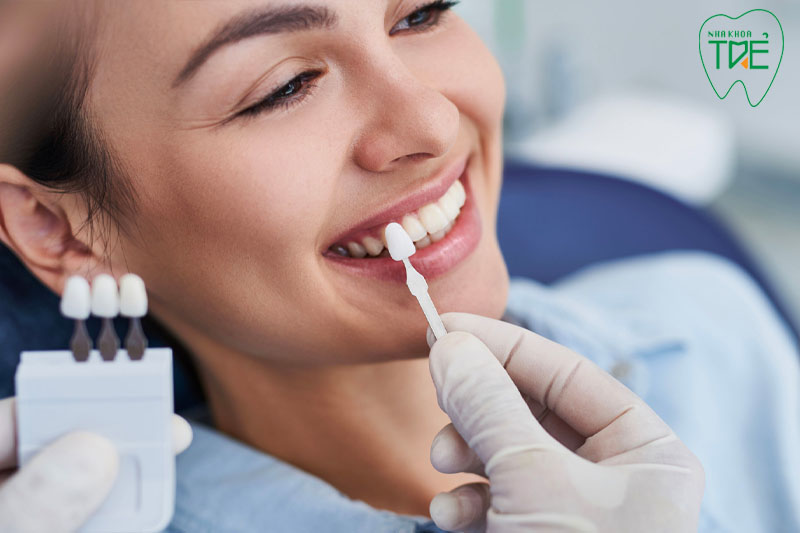 Lựa chọn răng sứ chất lượng cao
