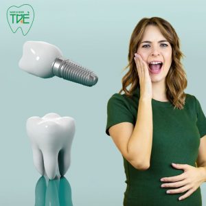 [Giải đáp] Đang mang thai có trồng răng Implant được không?