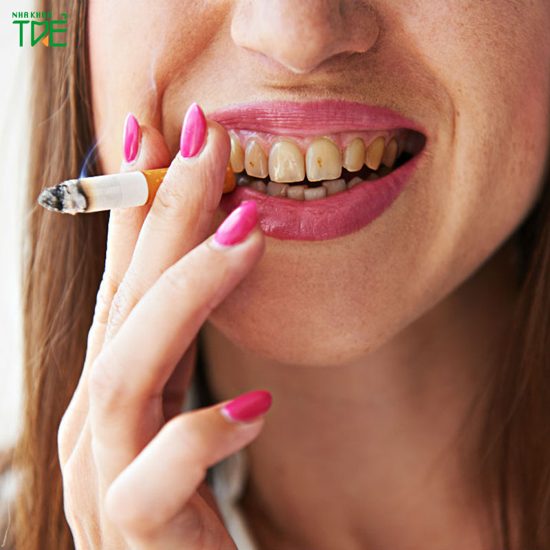 [Cảnh giác] Tác hại của thuốc lá đối với răng miệng