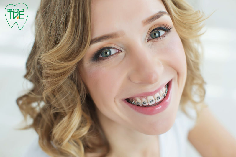 Niềng răng mang đến nhiều lợi ích về sức khỏe