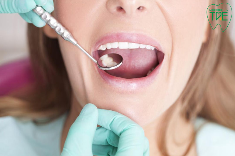 Chăm sóc răng miệng đúng cách để tăng tuổi thọ cho răng