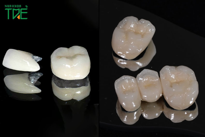 Răng sứ kim loại và răng sứ titan khác nhau màu sắc
