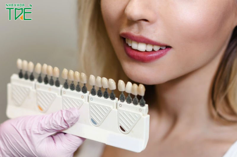 Bọc răng sứ có thay đổi khuôn mặt không? Trước và sau như thế nào?