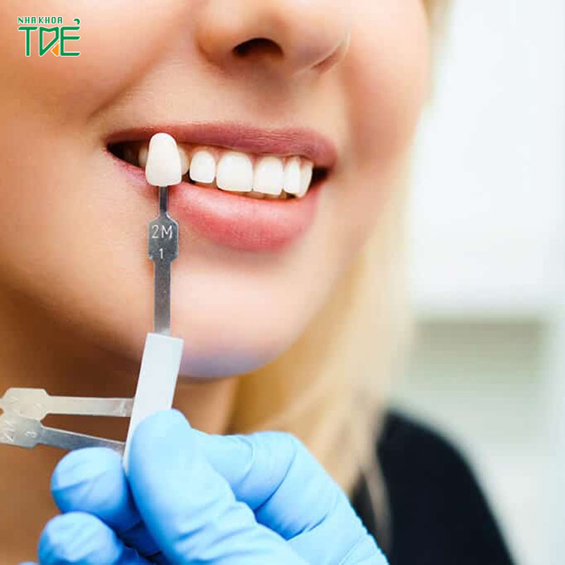 3 Biểu hiện sau bọc răng sứ thường gặp nhất – Cảnh giác bất thường