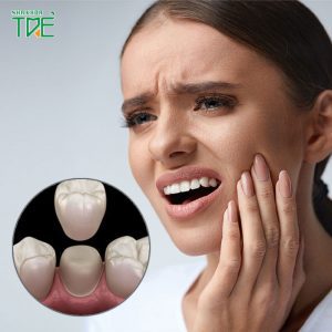 Bọc răng sứ có đau không? Có gây hại gì không?