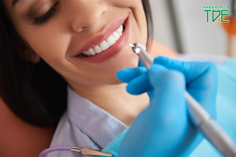Chăm sóc răng sau dán sứ Veneer: Những điều cần tuân thủ