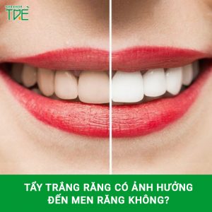 Tẩy trắng răng có ảnh hưởng đến men răng không?