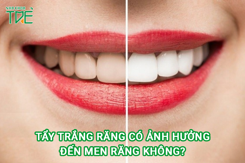 Tẩy trắng răng có ảnh hưởng đến men răng không?