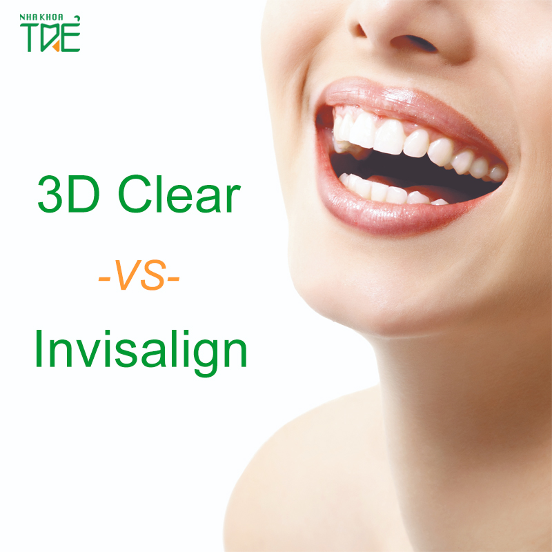 Niềng răng 3D Clear và Invisalign, đâu là lựa chọn tốt?