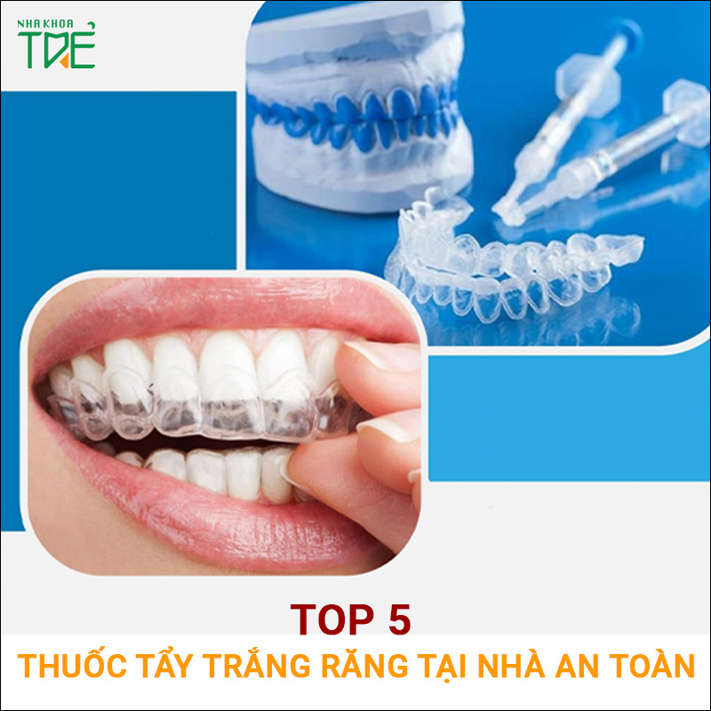 TOP 5 thuốc tẩy trắng răng tại nhà an toàn và chất lượng nhất