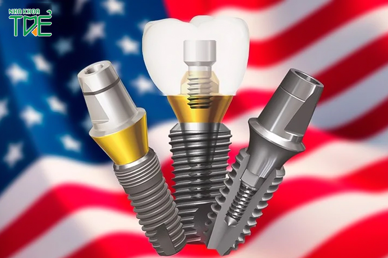Top 3 dòng trụ Implant Mỹ được ưa chuộng nhất