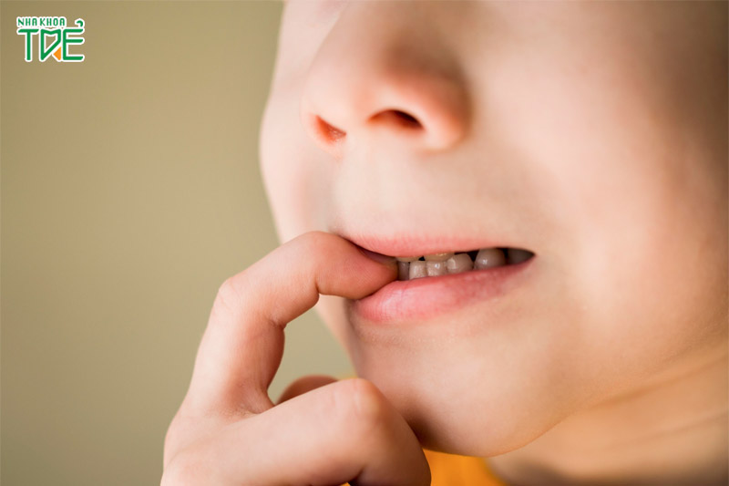 Răng hàm dưới hướng ra ngoài có thể xuất phát từ di truyền