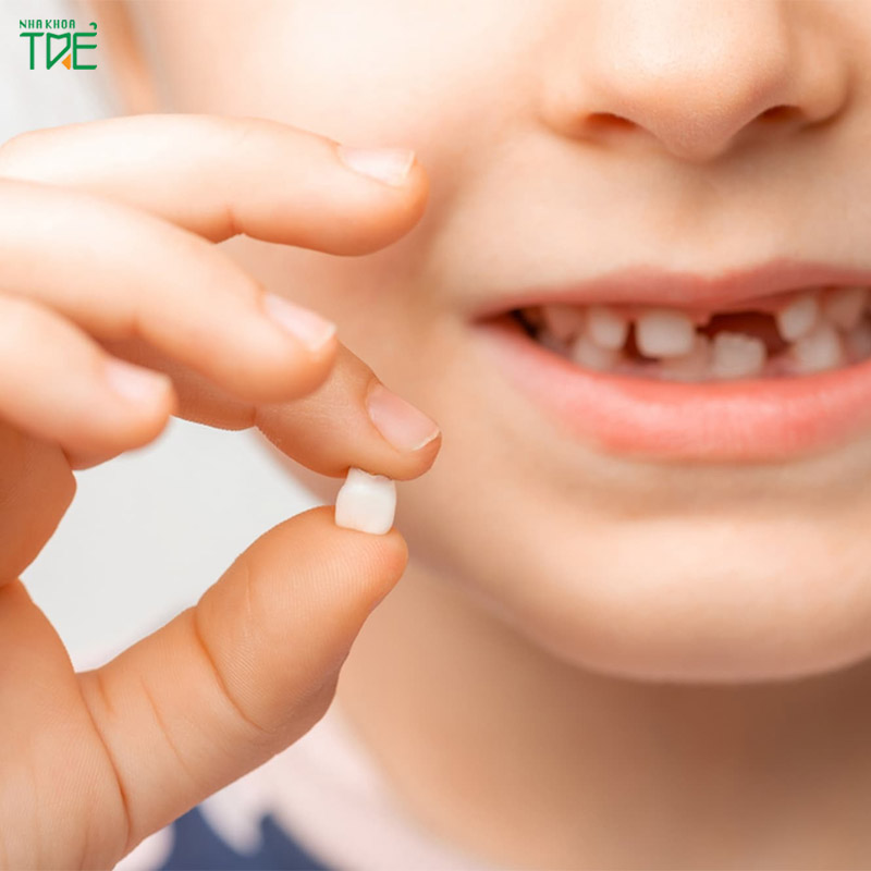 Bé 5 tuổi thay răng sữa có sớm không? Lưu ý quan trọng từ bác sĩ